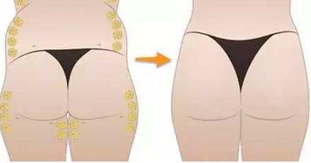 合肥哪家雙眼皮整形醫(yī)院口碑比較好？2024年排行前五的整形醫(yī)院有哪些？