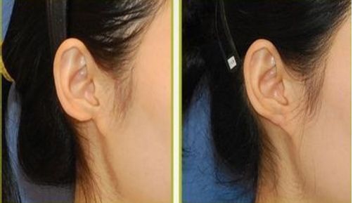 上海七強(qiáng)備受推崇的隆胸整形醫(yī)院大揭秘