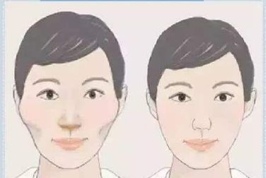 金華整形醫(yī)院：更受歡迎的隆鼻專家推薦