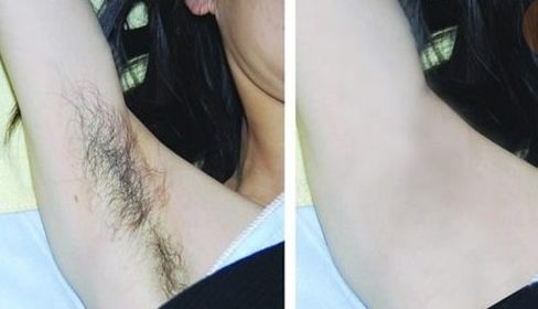 運(yùn)城腿部整形醫(yī)院哪家好？專業(yè)醫(yī)院推薦，讓您輕松擁有完美雙腿！