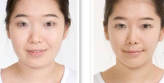 淮安眼角動態(tài)紋醫(yī)療整形醫(yī)院榜單：實力排行前10