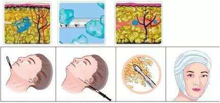 武漢哪家整形醫(yī)院口碑好？實(shí)力醫(yī)院前十推薦！