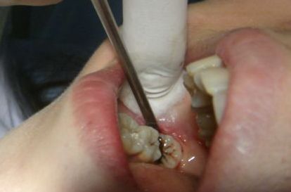 青島整形醫(yī)院拉皮手術(shù)排行榜的最新動(dòng)態(tài)