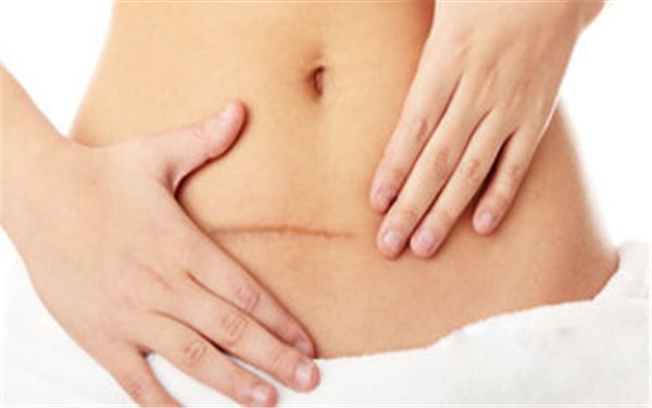 杭州熊貓針頸紋修復(fù)口碑前十揭秘