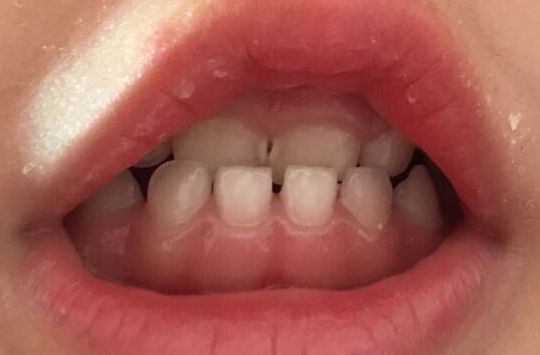 長沙市比較好的美容整形醫(yī)院推薦