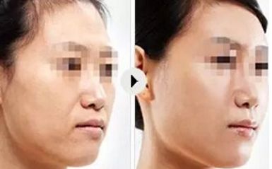 【武漢去眼紋整形醫(yī)院推薦】年度權(quán)威榜單出爐！