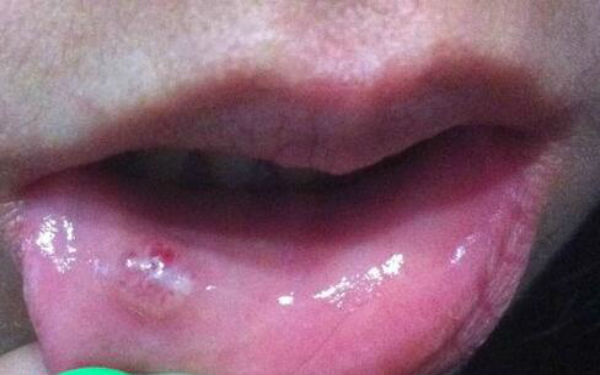 2023年值得選擇的鄭州雙眼皮修復醫(yī)院口碑TOP10