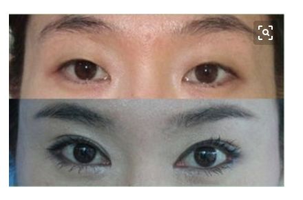 昆山線雕收緊下顎的醫(yī)院排名榜單發(fā)布！