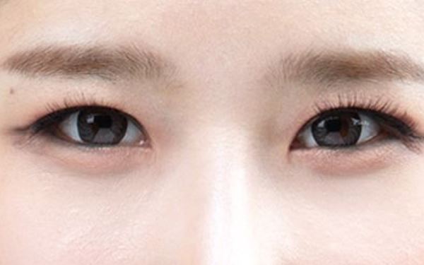 磨骨手術：如何降低風險及注意事項？