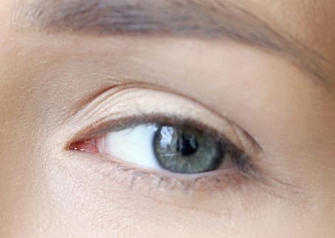 2023年武漢去除法令紋排行榜公布，十大整形醫(yī)院爭(zhēng)鋒相對(duì)