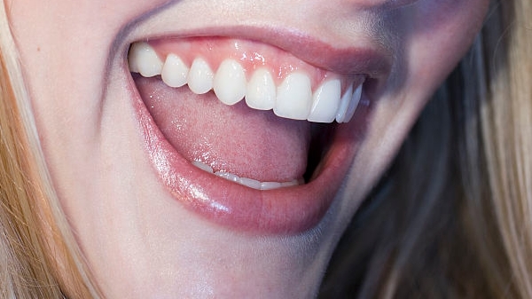 鎮(zhèn)江一流去鼻唇溝紋整形醫(yī)院推薦！2023年非常受歡迎的鎮(zhèn)江整容門診全新推出！