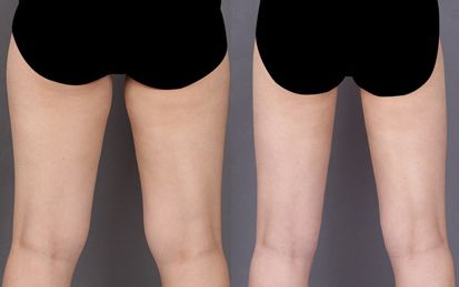 三亞哪家醫(yī)院做鼻子好？頂級整形醫(yī)院推薦大揭秘