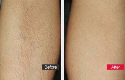 濟(jì)南乳房下垂矯正術(shù)推薦診所排行榜