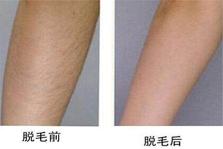 2023年武漢美鼻術(shù)整形醫(yī)院推薦！排行榜最新更新，哪些醫(yī)院受歡迎？