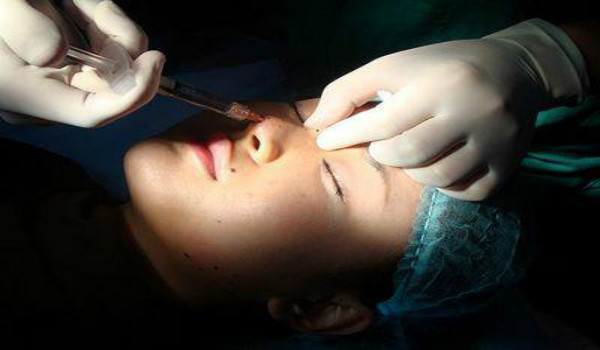 硅膠隆鼻的價格是多少？-專家分享真實費(fèi)用