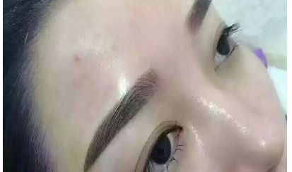 nana經(jīng)歷了整容手術(shù)嗎？揭秘真相！