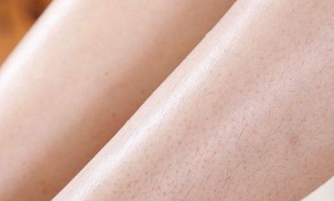 徐州祛雀斑醫(yī)院哪家好？專家解讀TOP10徐州祛斑醫(yī)院推薦