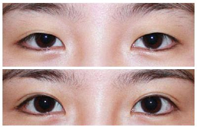 南京哪所整容醫(yī)院的面部脂肪雕刻效果比較好？2023南京面部脂肪雕刻院根據(jù)排名，這些醫(yī)院TOP10榜單值得關(guān)注