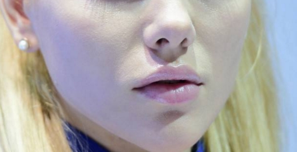 2023年哈爾濱眼部整形醫(yī)院排名公布！治療眼睛細(xì)紋好的小切口醫(yī)院TOP10