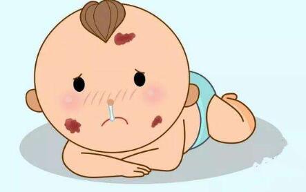 拉皮手術(shù)最佳年齡和術(shù)后疤痕如何？