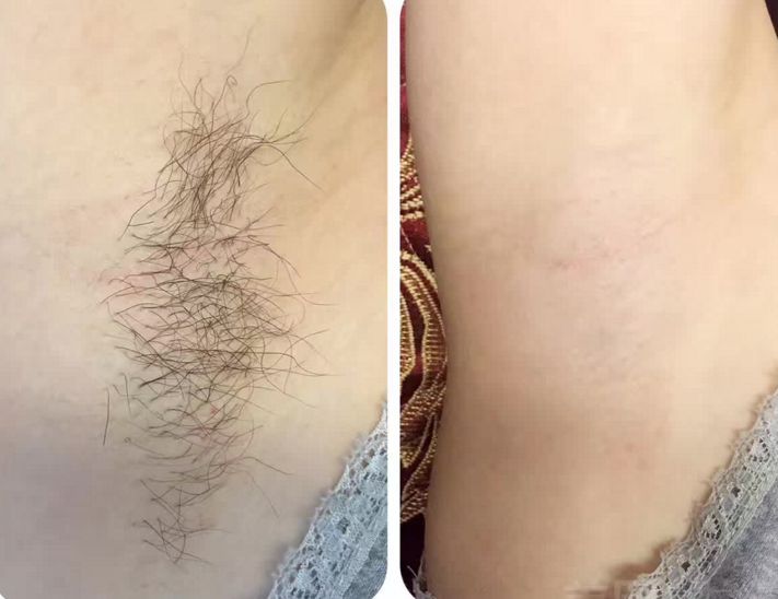 沈陽哪家醫(yī)院去眼袋做的好？頂級專家?guī)湍憬獯穑?></div>
                            <div   id=