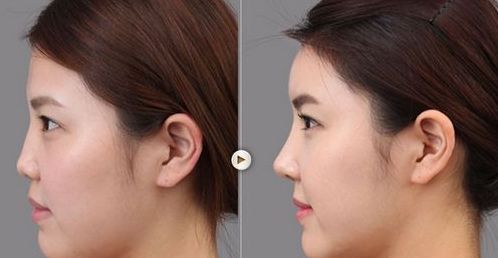 太原好的美容醫(yī)院是哪家？國內(nèi)口碑最佳的太原美容醫(yī)院排行榜一覽