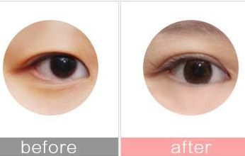 優(yōu)質(zhì)的南昌光子嫩膚整形醫(yī)院推薦！選擇佳美、韓美等可信賴！2023最新資訊！