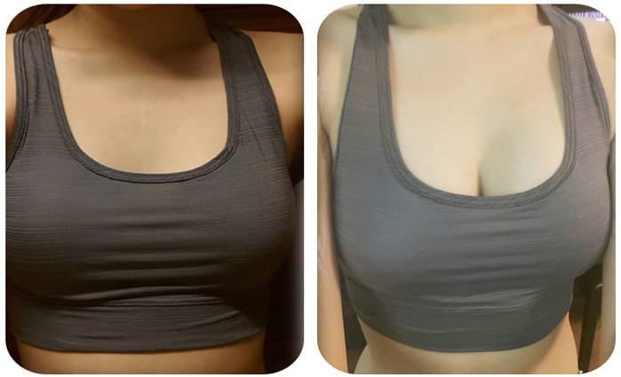 長沙乳頭整形醫(yī)院哪家好？私立醫(yī)美機(jī)構(gòu)中有哪些技術(shù)出眾的醫(yī)院？