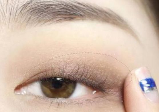 杭州熱瑪吉哪家做的好？濃縮選擇好癥，推薦杭州頂級(jí)熱瑪吉機(jī)構(gòu)