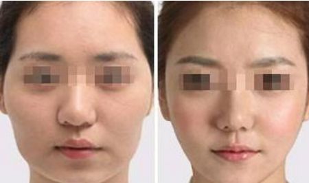 武漢醫(yī)美除魚尾紋十大醫(yī)院推薦