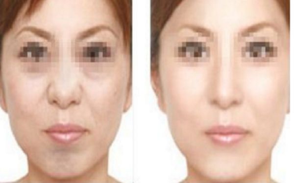 黑龍江口碑好的胎記祛除醫(yī)院盤點(diǎn)：詳細(xì)對比