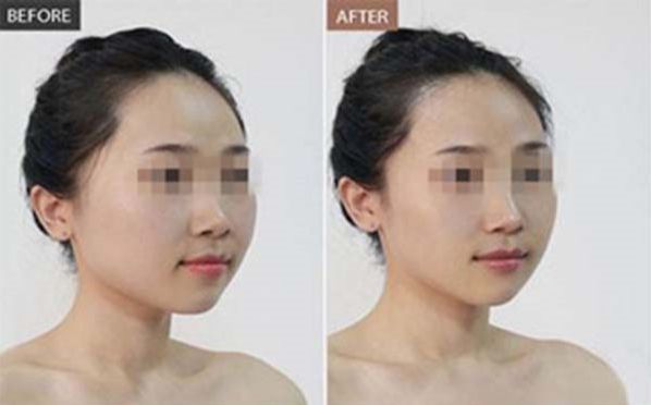 東莞納晶祛痘專家推薦，排名前10的醫(yī)院分享