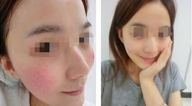 2024年紹興雙眼皮醫(yī)院排行榜出爐！年度10家醫(yī)院大揭秘！