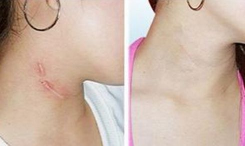 成都眼角紋手術(shù)醫(yī)院推薦：10大整形機(jī)構(gòu)實(shí)力大盤(pán)點(diǎn)