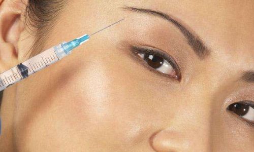 北京去眼周細(xì)紋正規(guī)醫(yī)院十強(qiáng)推薦，內(nèi)行經(jīng)驗(yàn)分享