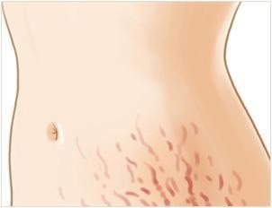 韓佳人近照曝光，她如何度過隱退生子后的日子？