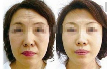 長沙整形醫(yī)院十強榜單：塑造美麗，盡顯魅力