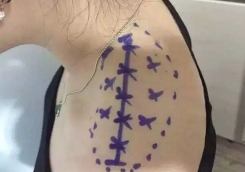 成都有資深醫(yī)生推薦！眼部年輕化全攻略揭秘！