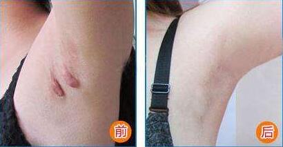 江映蓉整容后風(fēng)格大變？認(rèn)不出來(lái)是她嗎