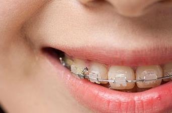 南華大學(xué)附屬第一醫(yī)院整形外科好嗎？是三甲醫(yī)院嗎？參考價格表