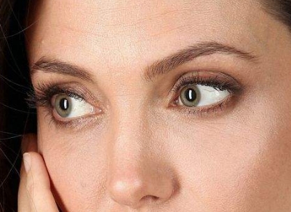 2023深圳內(nèi)窺鏡除皺去唇紋美容醫(yī)院高口碑排行榜，賦能您邁向年輕肌膚的十大佳選！