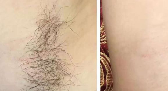 連云港激光醫(yī)院排名前三，哪家好？