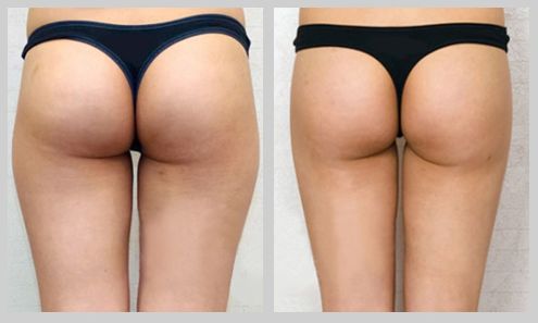 云南做熱瑪吉整形醫(yī)院哪家好，專家推薦的熱瑪吉美容醫(yī)院Top選擇