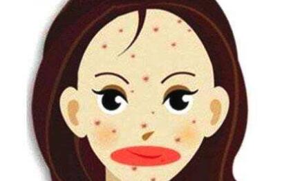 開眼角手術(shù)的價格是多少呢？術(shù)后該如何護(hù)理呢？