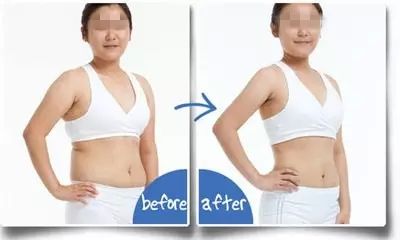 廣東地區(qū)優(yōu)質(zhì)蘋果肌整形醫(yī)院推薦！2023年口碑比較好的前10家推薦！