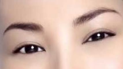 隆鼻修復手術的花費是怎樣的？手術效果如何評價？