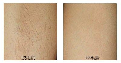 深圳港大醫(yī)院整形科好嗎？如何掛號(hào)，懂醫(yī)生的干貨嗎？