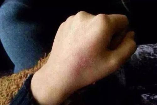 北京青春痘醫(yī)療美容醫(yī)院2023年評(píng)分前10名公私對(duì)比！尋找值得去的復(fù)合彩光治療醫(yī)院