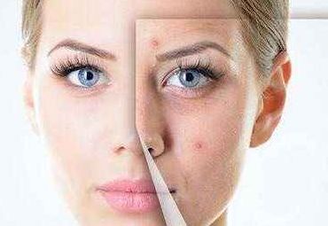 鄭州祛疤痕醫(yī)院哪家好？選擇哪家專業(yè)機構(gòu)更安全有效