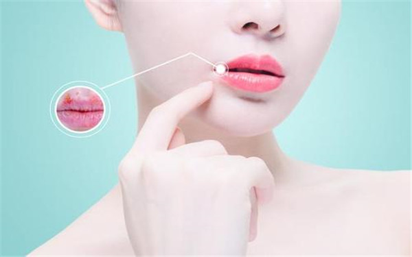 臺(tái)州椒江長(zhǎng)青門診部的整形效果如何？有哪些祛痘治療案例？?jī)r(jià)格合理嗎？